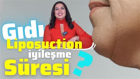 Kız Bebek Sünneti Sonrası İyileşme Süresi Ne Kadardır?